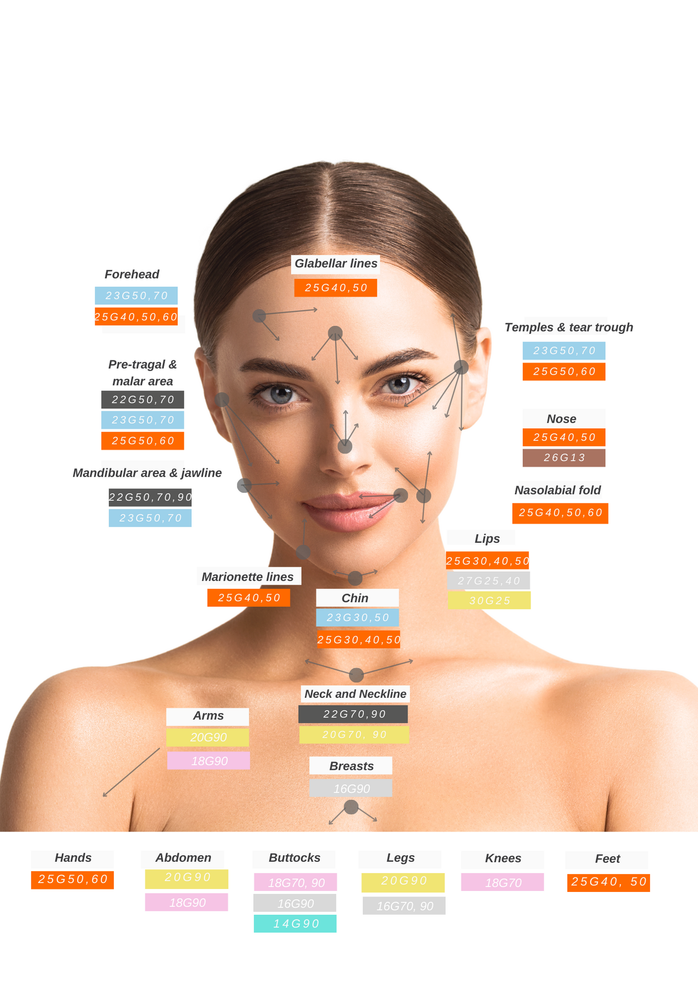 SoftFil Precision Kanülen – Bild 2