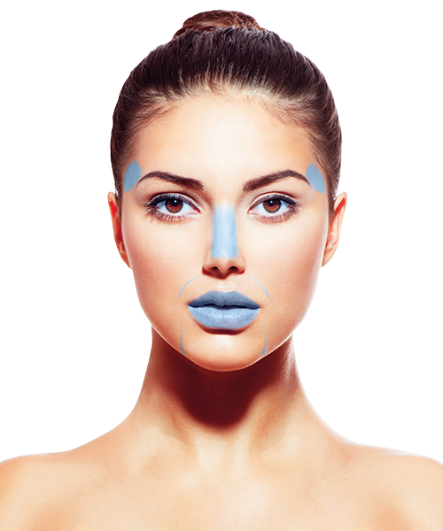 Opera Strong – Bild 2