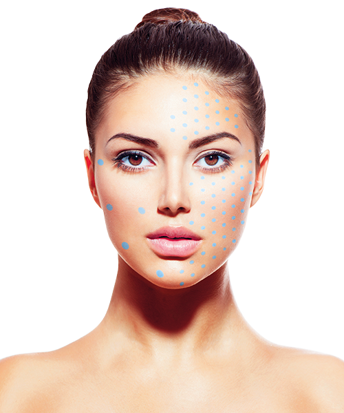 Opera Evolution S 1 ml – Bild 3