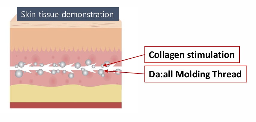 Premium Molding Emboss – Bild 3